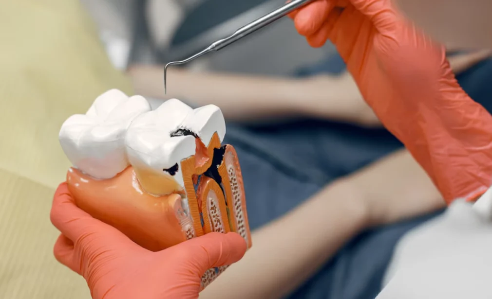 Root Canal Treatment