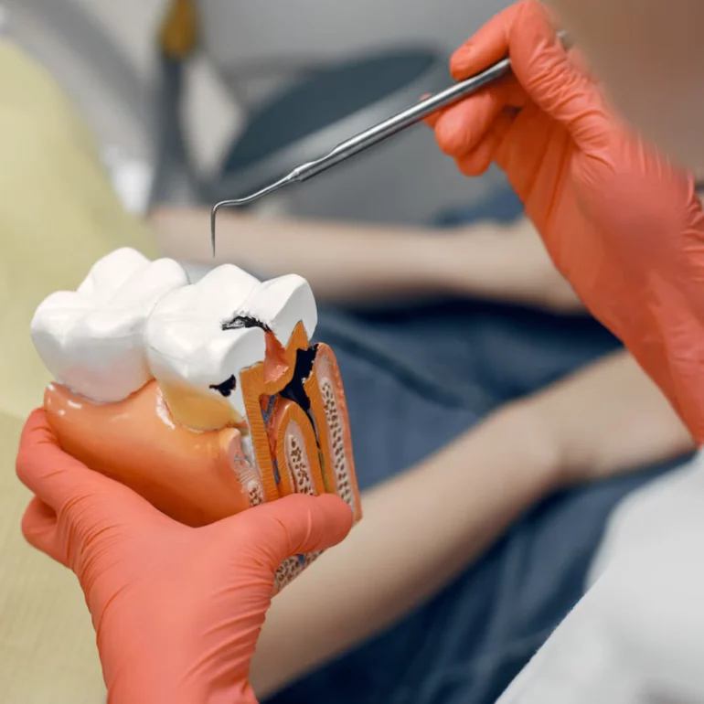 Root Canal Treatment